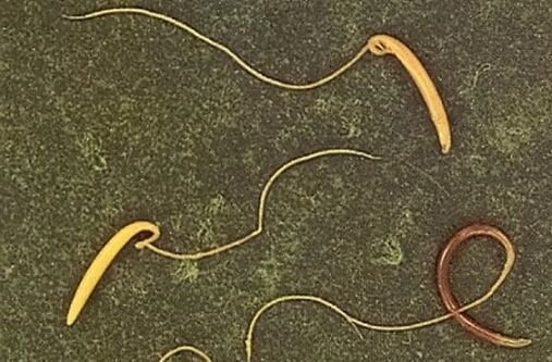 bičíkovce z lidského těla