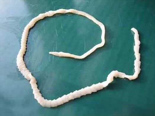 lidská vepřová tasemnice