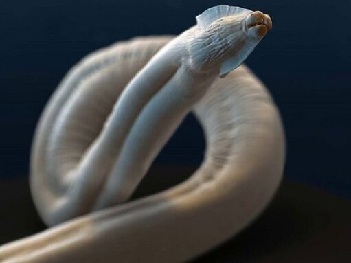 toxocara z lidského těla