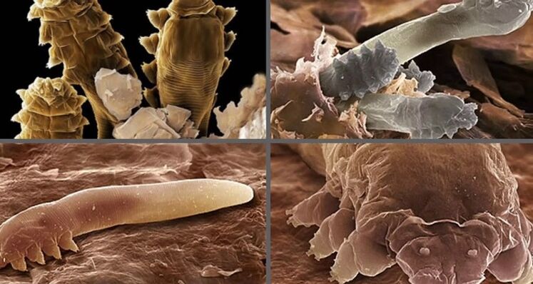 typy lidských kožních parazitů