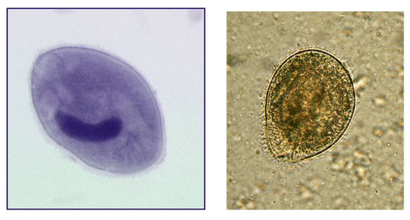 Balantidia ciliates, parazitující v tlustém střevě